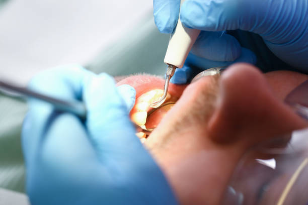 Best Teeth Whitening  in Mascotte, FL
