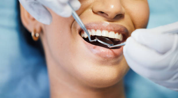 Best Urgent Tooth Repair  in Mascotte, FL